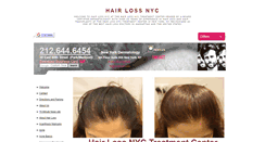 Desktop Screenshot of hairlossnycsite.com